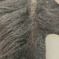 Hair Detox